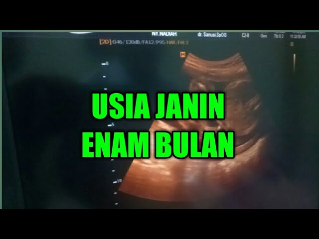 Detail Gambar Asli Janin 5 Bulan Nomer 39