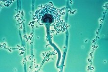 Detail Gambar Aspergillus Niger Nomer 11