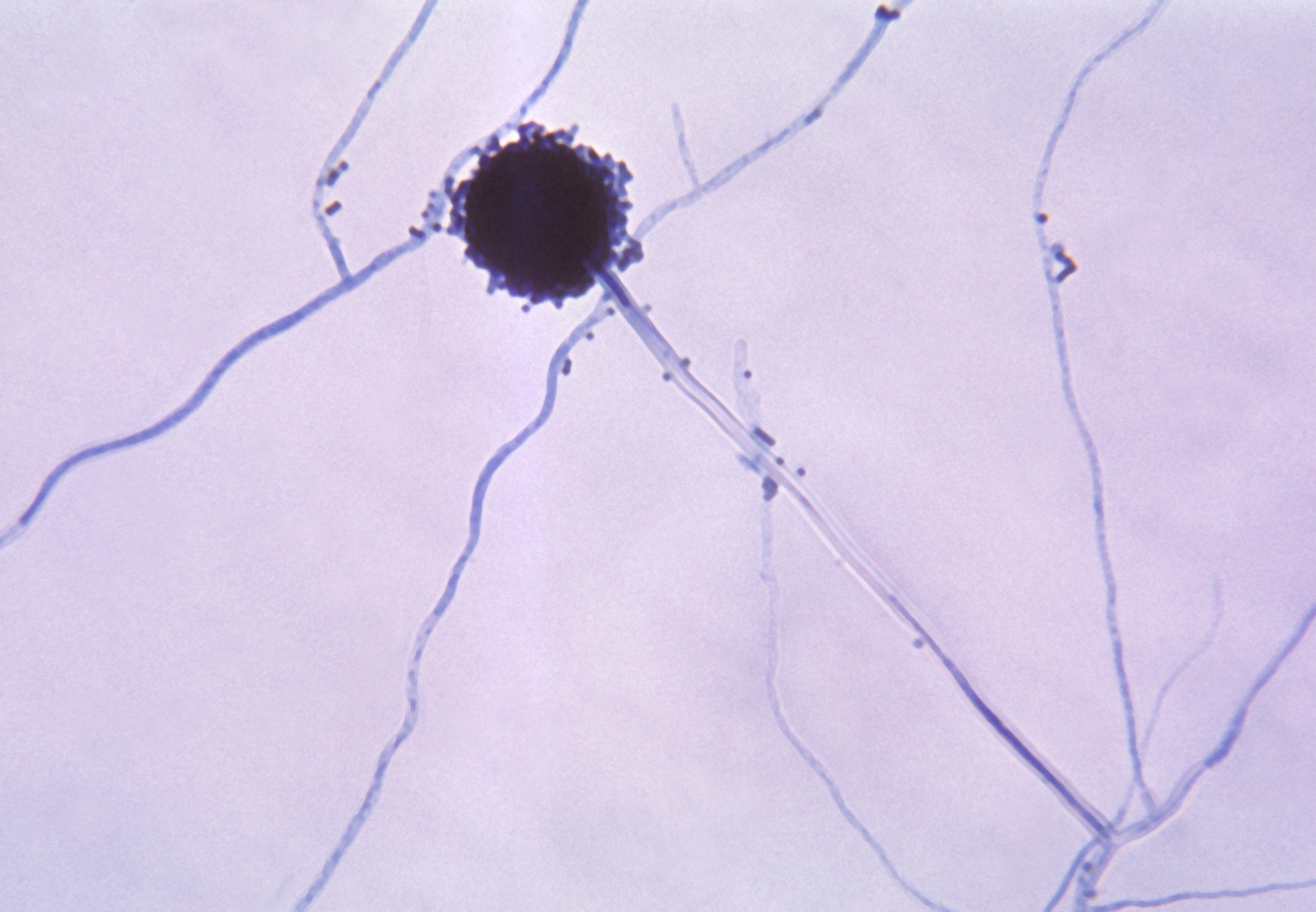 Detail Gambar Aspergillus Niger Nomer 15