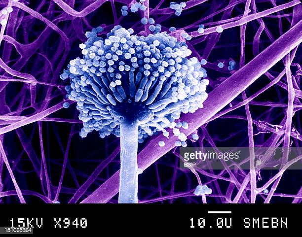 Detail Gambar Aspergillus Niger Nomer 3