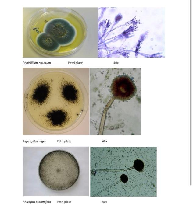 Detail Gambar Aspergillus Niger Nomer 27