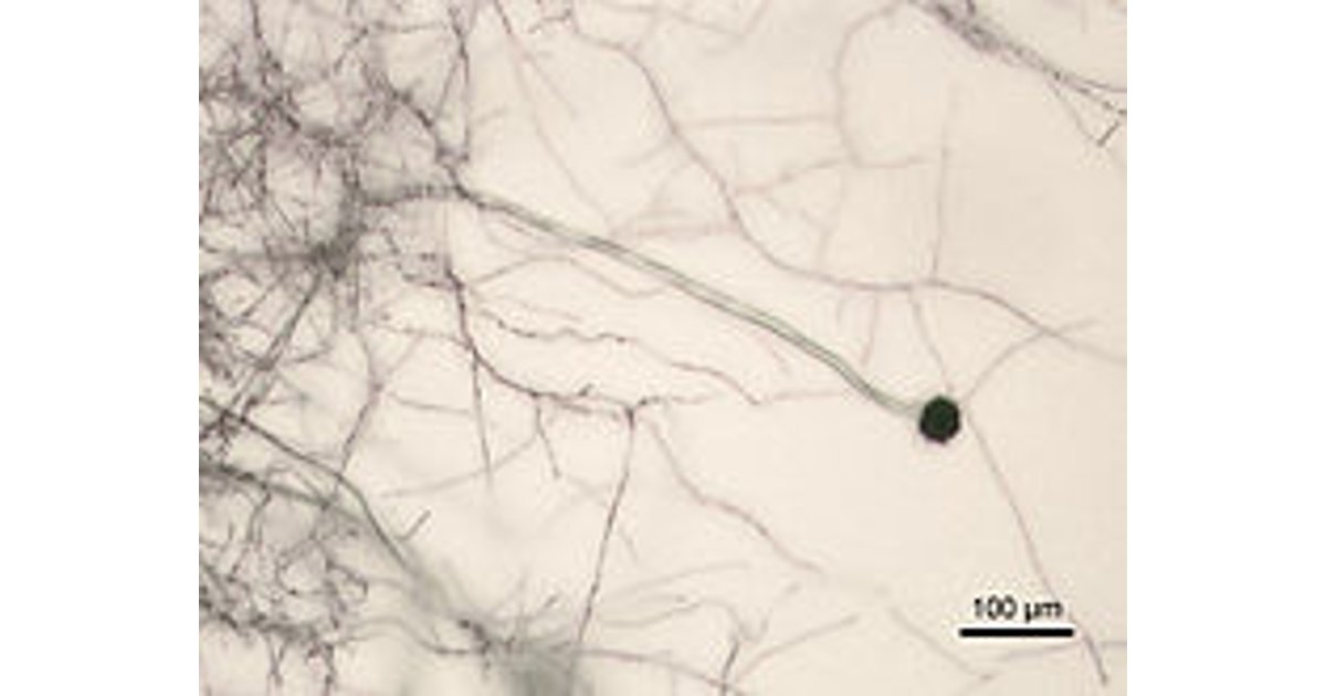 Detail Gambar Aspergillus Niger Nomer 28