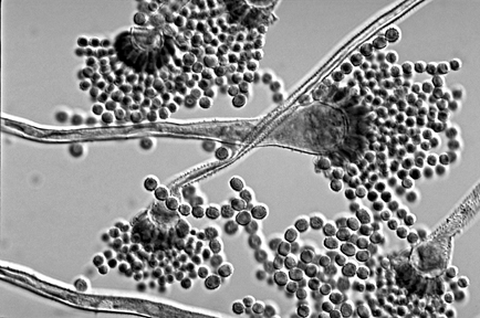 Detail Gambar Aspergillus Niger Nomer 34