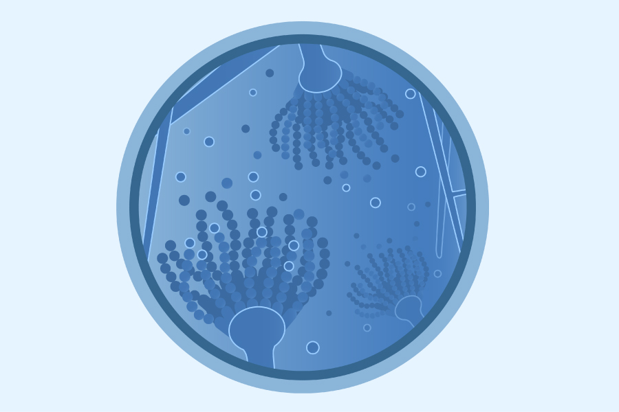 Detail Gambar Aspergillus Niger Nomer 45