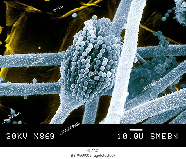 Detail Gambar Aspergillus Niger Nomer 46