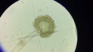 Detail Gambar Aspergillus Niger Nomer 7