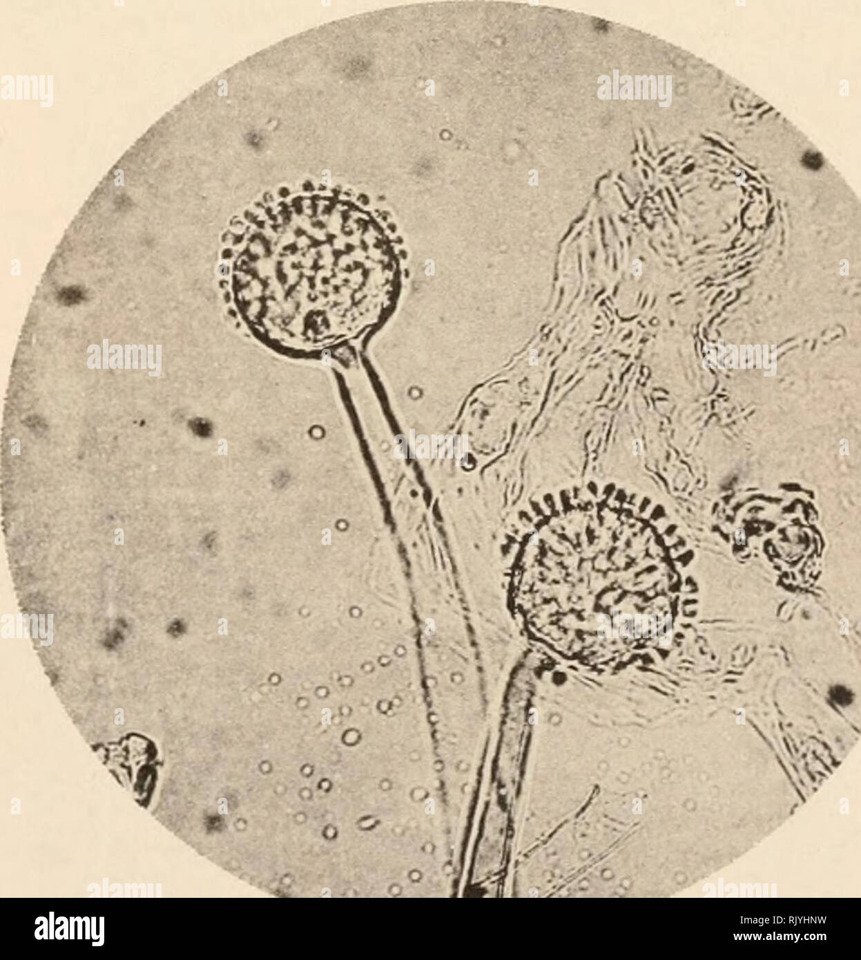 Detail Gambar Aspergillus Niger Nomer 8