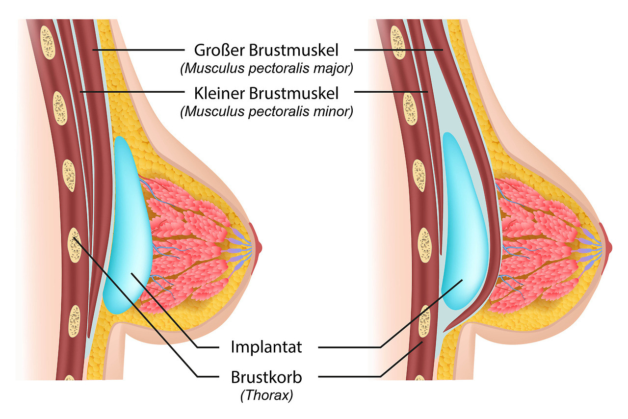 Detail Aufbau Der Weiblichen Brust Nomer 7