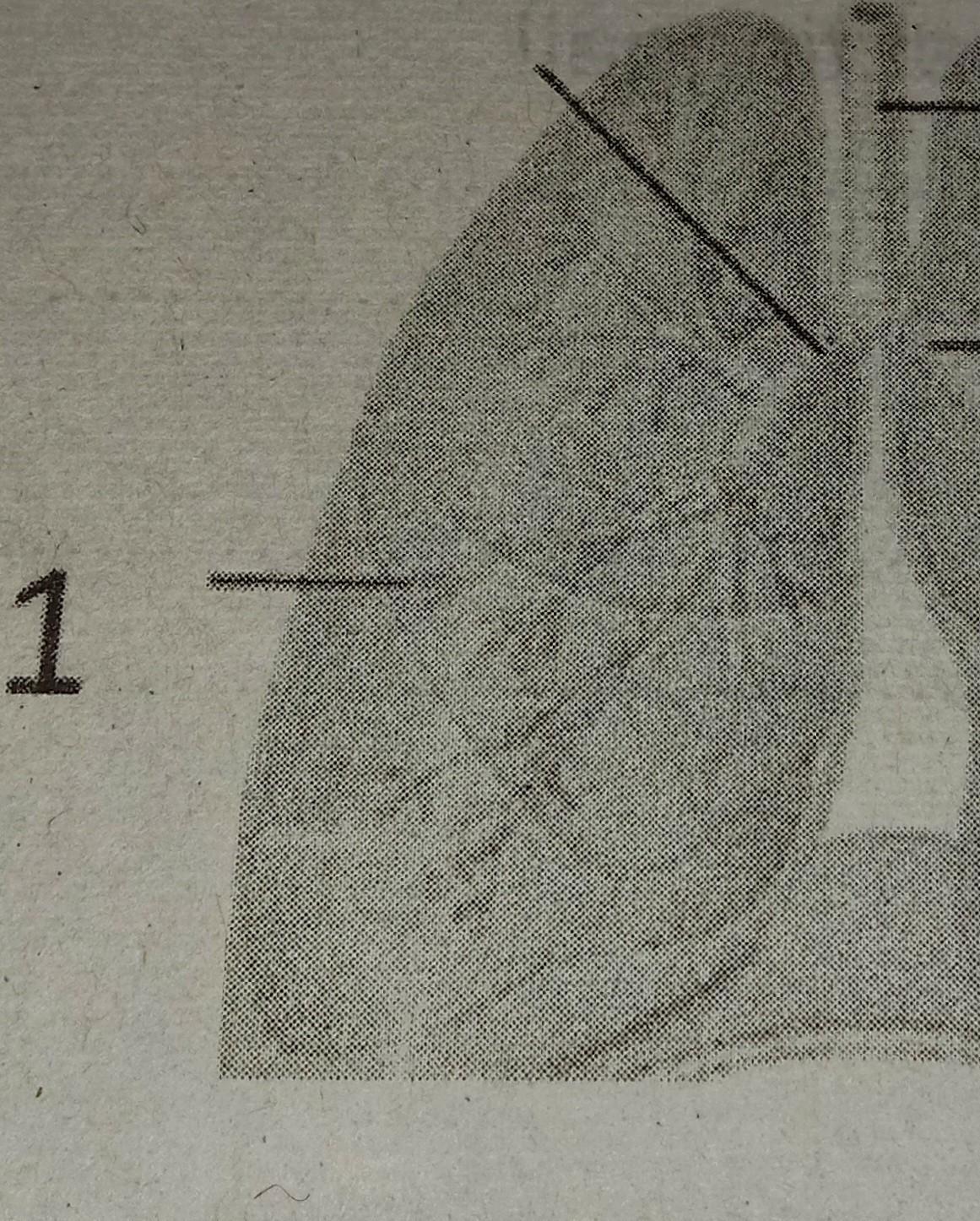 Detail Gambar Bagian Bagian Paru Paru Nomer 53