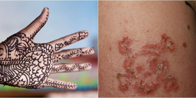 Detail Gambar Bahaya Pakai Henna Nomer 8