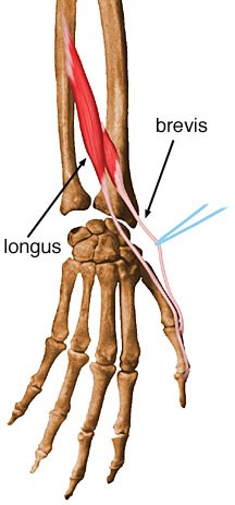Detail Musculus Abductor Pollicis Brevis Nomer 7