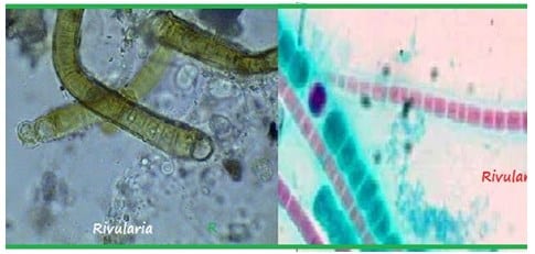 Detail Gambar Bakteri Cyanobacteria Nomer 29