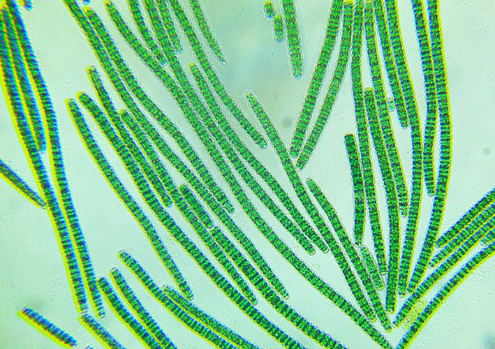 Detail Gambar Bakteri Cyanobacteria Nomer 9