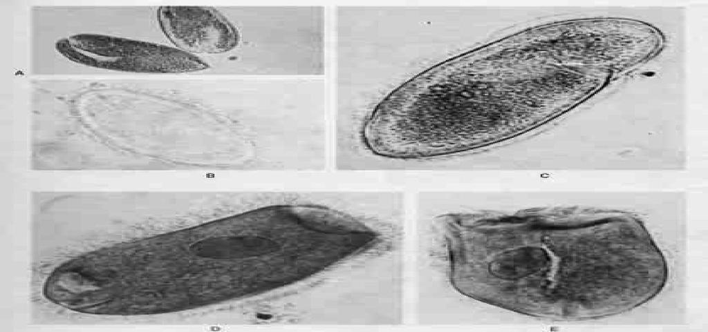 Detail Gambar Bakteri Dalam Rumen Nomer 44