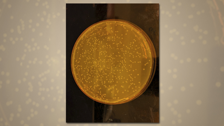 Detail Gambar Bakteri E Colli Nomer 44