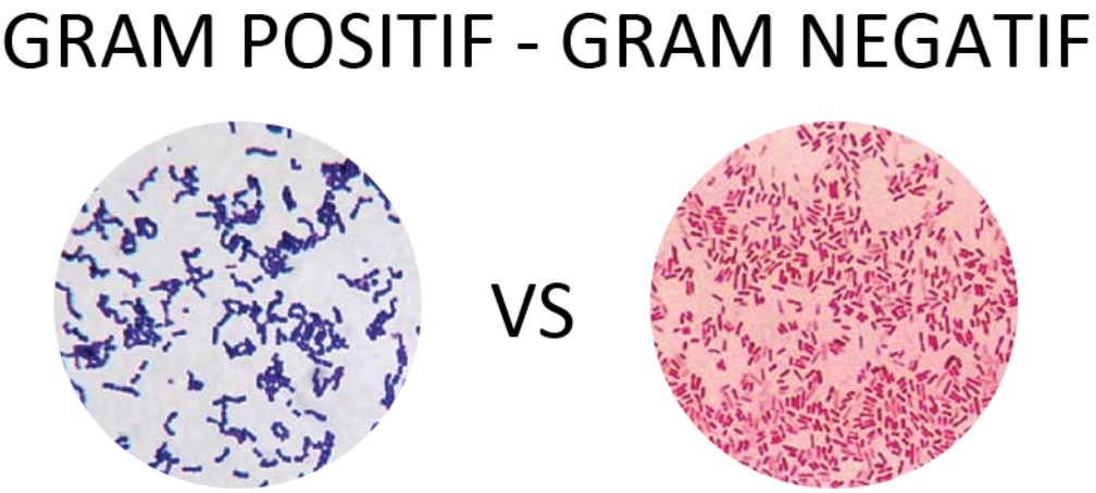 Detail Gambar Bakteri Gram Positif Dan Negatif Nomer 21
