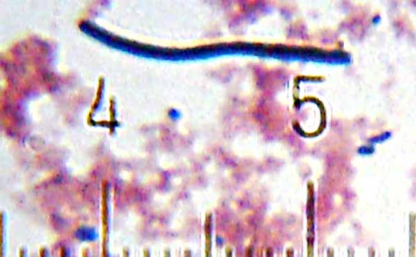 Detail Gambar Bakteri Lactobacillus Bulgaricus Nomer 17