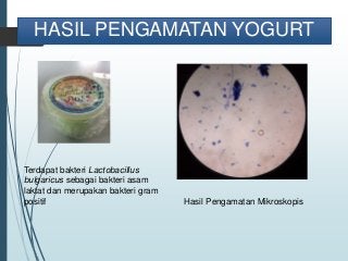 Detail Gambar Bakteri Lactobacillus Bulgaricus Nomer 51