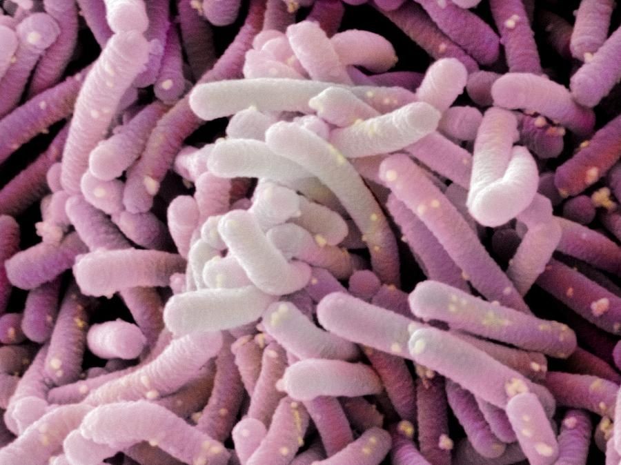 Download Gambar Bakteri Lactobacillus Bulgaricus Nomer 52