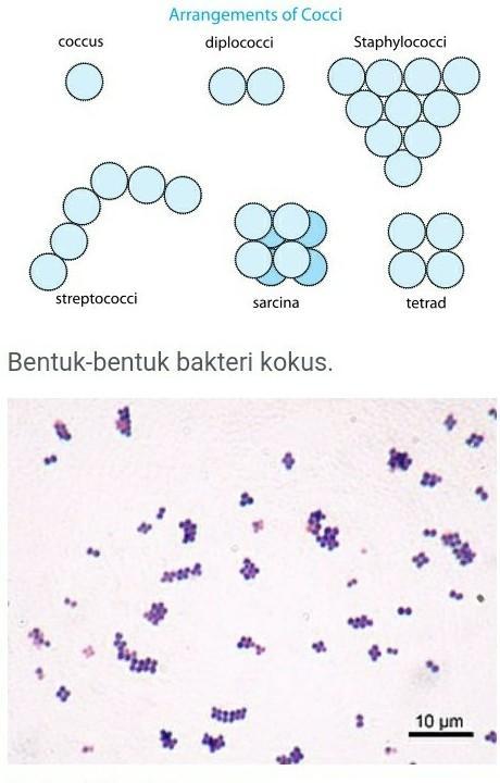 Detail Gambar Bakteri Monokokus Nomer 47