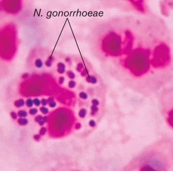 Detail Gambar Bakteri Monokokus Nomer 51