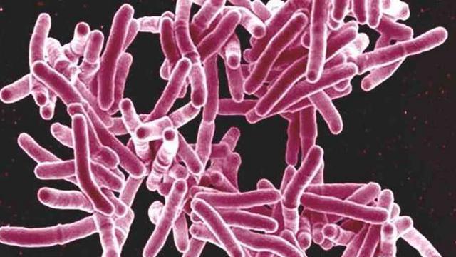 Detail Gambar Bakteri Mycobacterium Tuberculosis Nomer 9