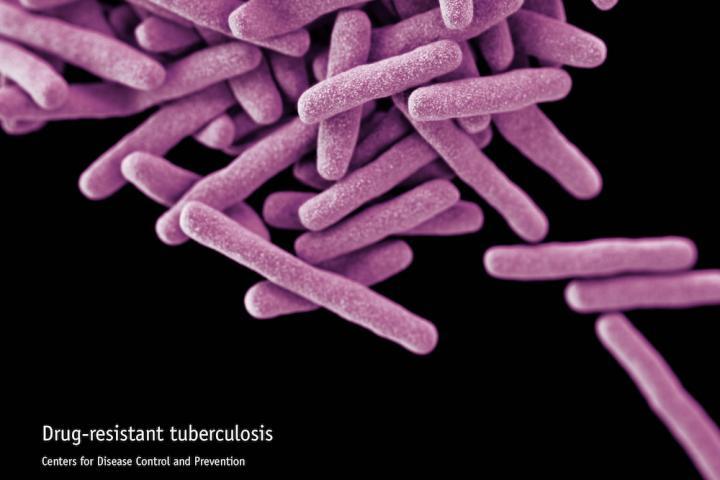 Detail Gambar Bakteri Mycobacterium Tuberculosis Nomer 18