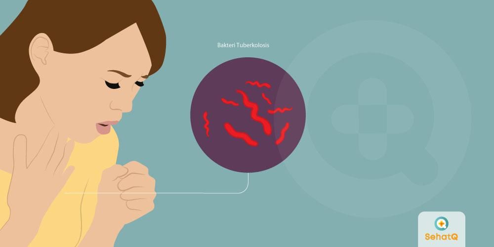 Detail Gambar Bakteri Mycobacterium Tuberculosis Nomer 28