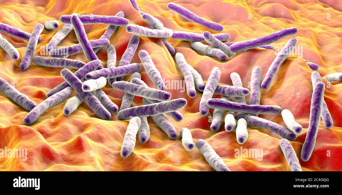 Detail Gambar Bakteri Mycobacterium Tuberculosis Nomer 35