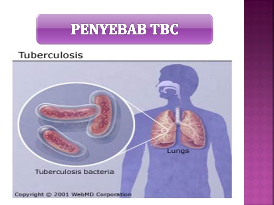 Detail Gambar Bakteri Mycobacterium Tuberculosis Nomer 41