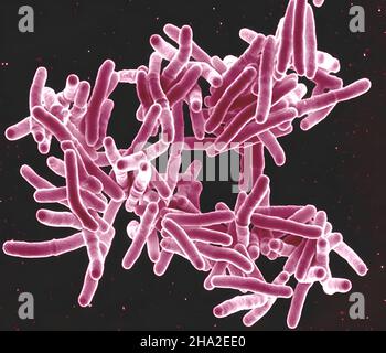 Detail Gambar Bakteri Mycobacterium Tuberculosis Nomer 4