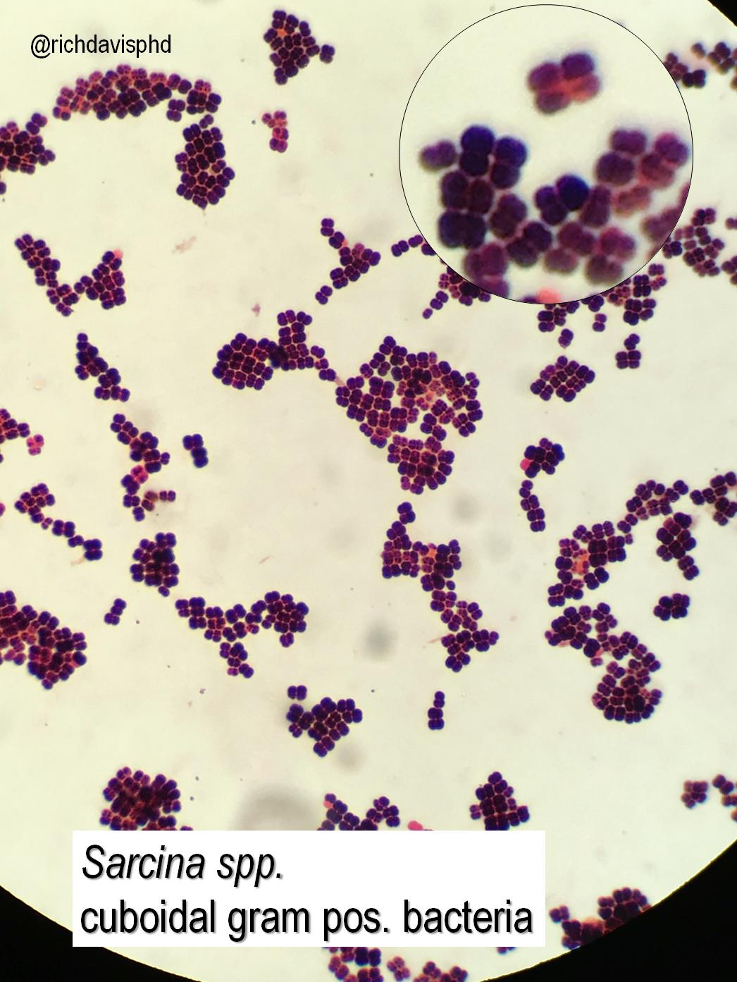 Detail Gambar Bakteri Sarcina Nomer 50