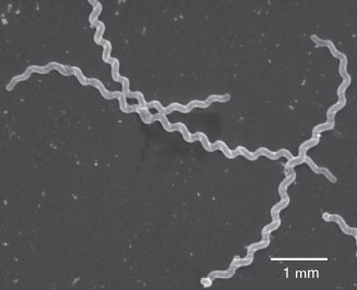 Detail Gambar Bakteri Spiral Nomer 36