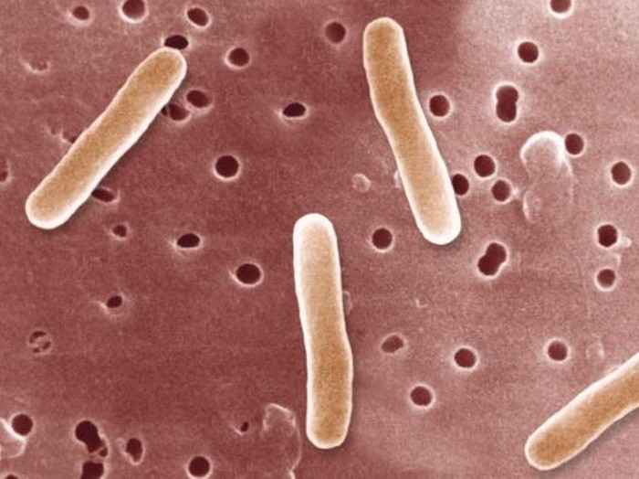 Detail Gambar Bakteri Typoid Nomer 12