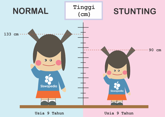 Detail Gambar Balita Stunting Nomer 24