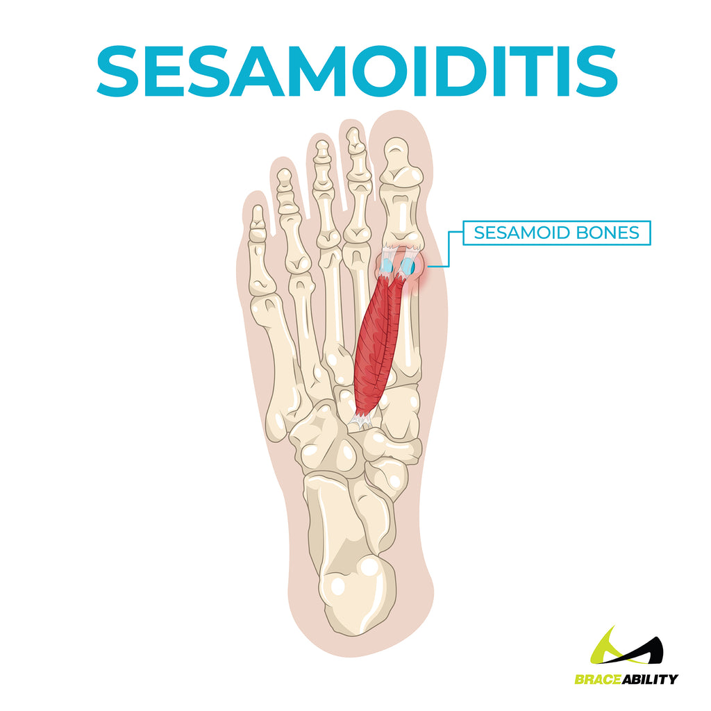 Detail Gambar Ball For Foot Pain Nomer 12