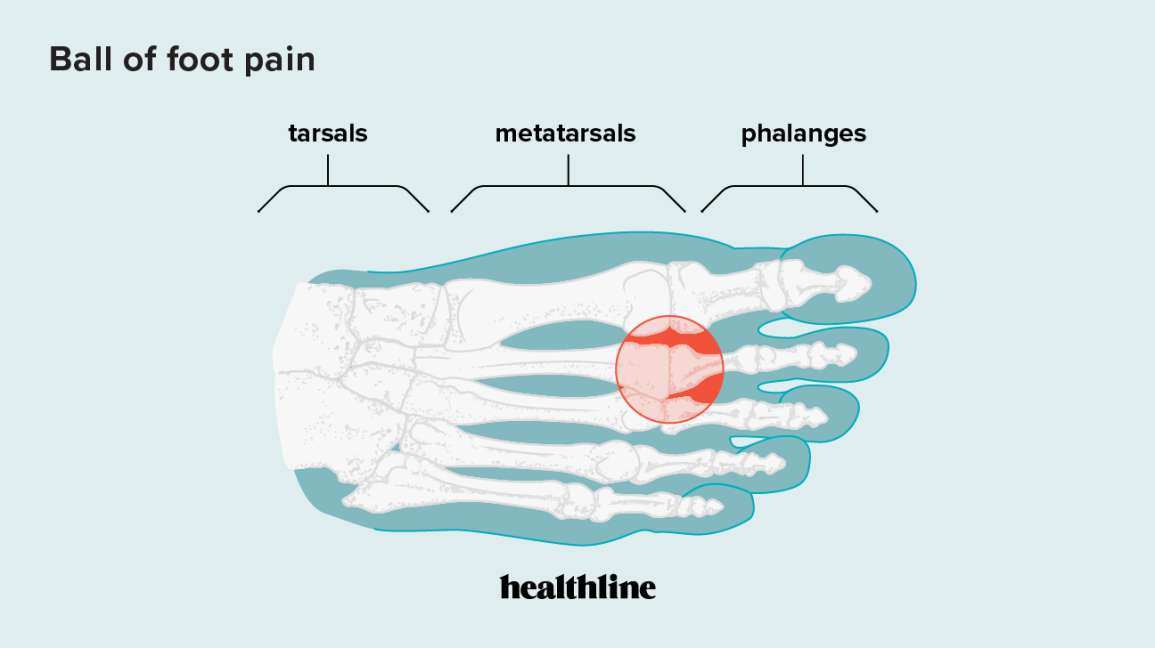 Detail Gambar Ball For Foot Pain Nomer 6