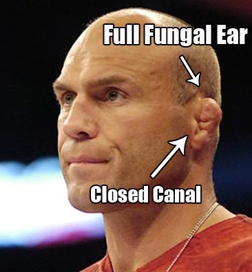 Detail Cauliflower Ear Meme Nomer 22