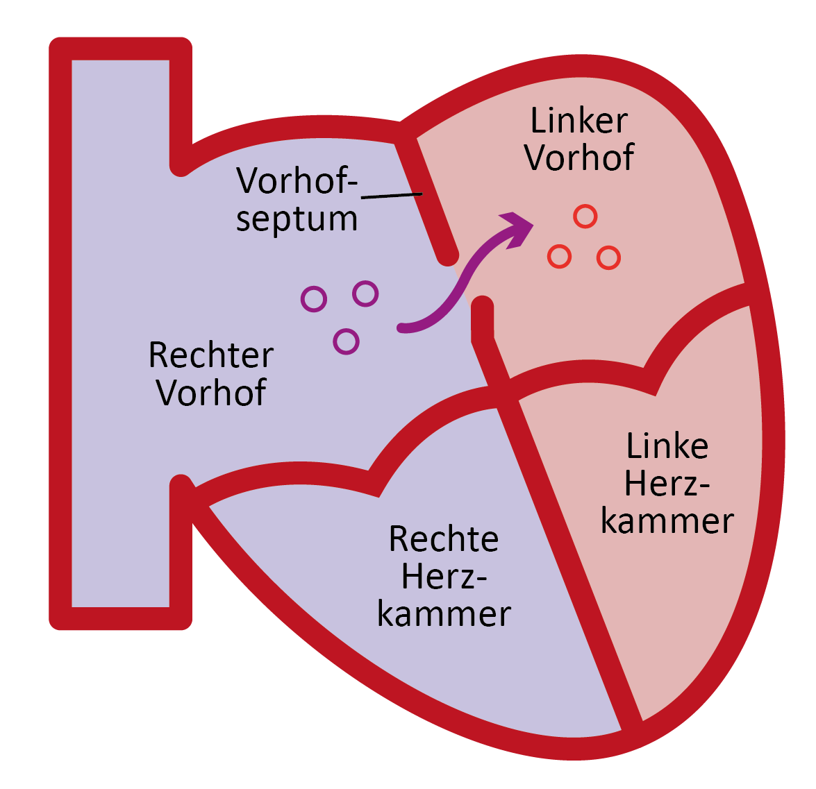 Detail Hirnblutung Bilder Nomer 15