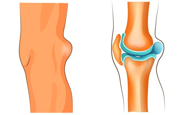 Detail Anatomie Schaubild Nomer 12
