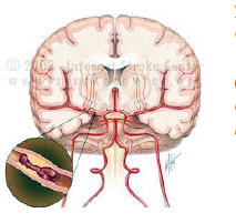 Detail Gambar Batang Otak Nomer 39