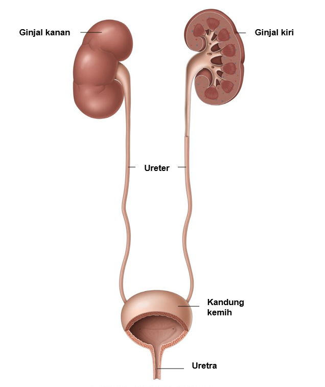 Detail Gambar Batu Saluran Kemih Nomer 7