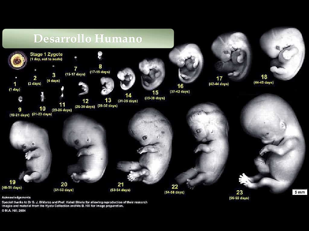 Detail Gambar Bayi 1 Bulan Dalam Kandungan Nomer 5