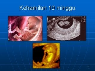 Detail Gambar Bayi 10 Minggu Nomer 54
