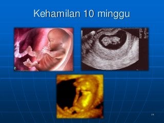 Download Gambar Bayi 10 Minggu Nomer 54