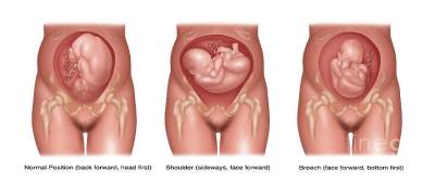 Detail Gambar Bayi 8 Bulan Dalam Kandungan Nomer 48