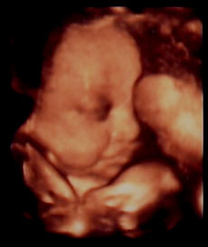 Detail Gambar Bayi 8 Bulan Dlm Kandungan Nomer 56