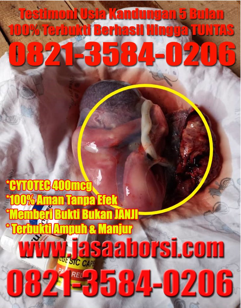 Detail Gambar Bayi Aborsi Usia 1 Bulan Nomer 15