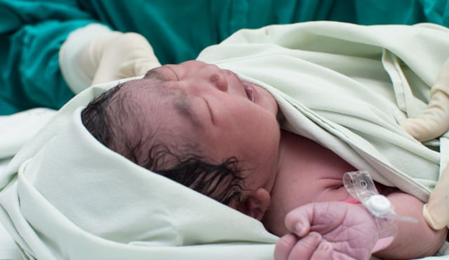 Detail Gambar Bayi Baru Lahir Normal Nomer 48
