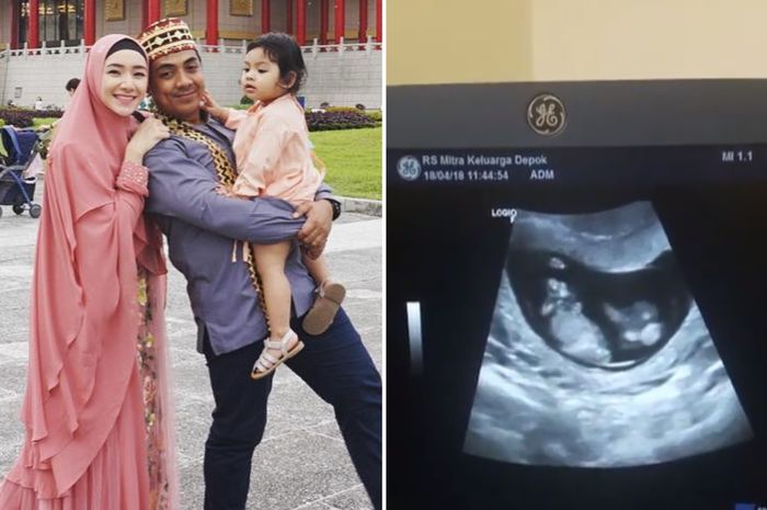 Detail Gambar Bayi Dalam Kandungan 3 Bulan Nomer 14